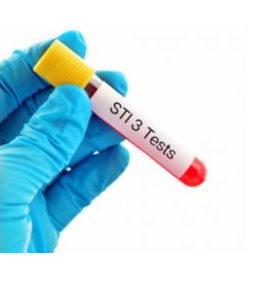 Essential STD Test