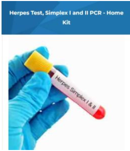 Herpes Test Importance
