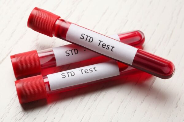 STD Test