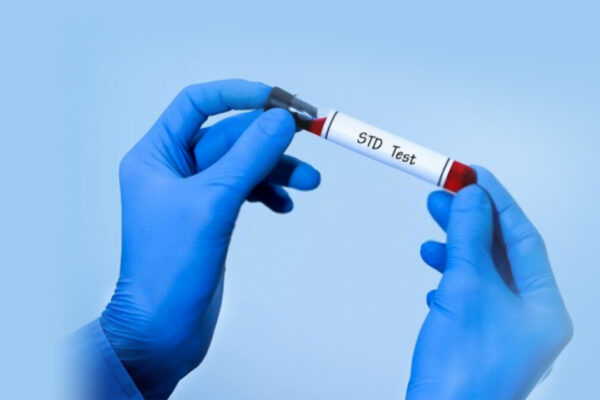 STD Test Guidelines
